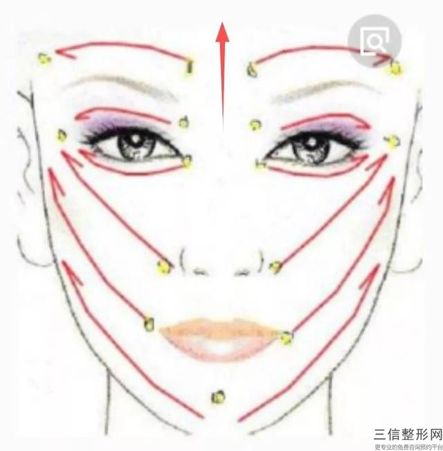 顴骨縮小手術效果能持續多久