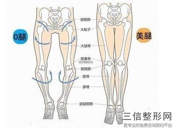 7615元進行冷凍溶脂重塑雙腿曲線貴嗎