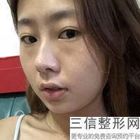 小陰唇縮小一般多少錢(小陰唇縮小大概價格參考表)