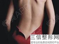 面部吸脂和整容有什么好處？吸脂的科學(xué)原理是什么？