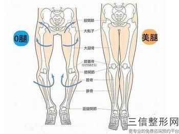 吸脂會(huì)失去手臂、大腿和臉，那么吸脂有副作用嗎？