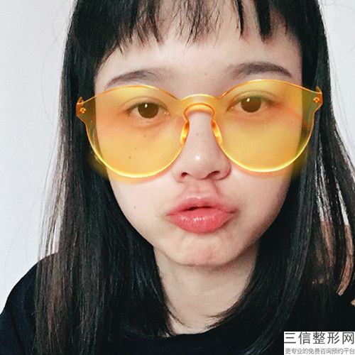 女性月經(jīng)期間可以割雙眼皮嗎？專家：良好不要有