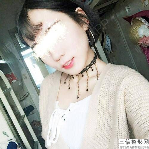 黑臉娃娃美白嫩膚會有什么后果？娃娃嫩膚并發癥