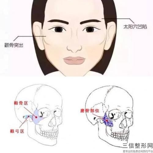 顴骨塑形的術前準備有哪些？顴骨整形應避開月經期