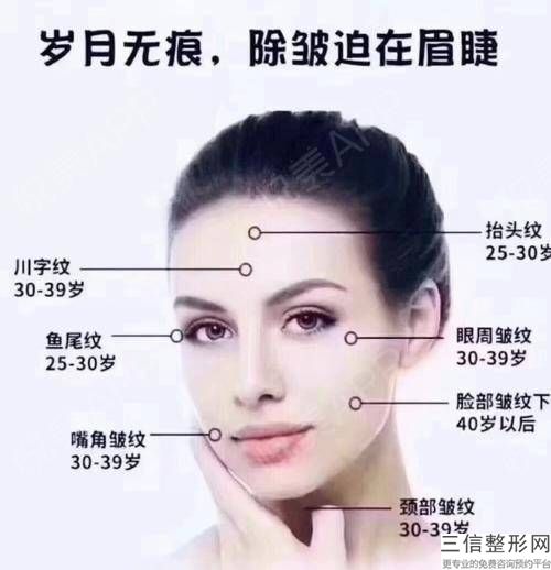 福州祛皺美白在哪里？?jī)r(jià)格是多少？皺紋的狀態(tài)