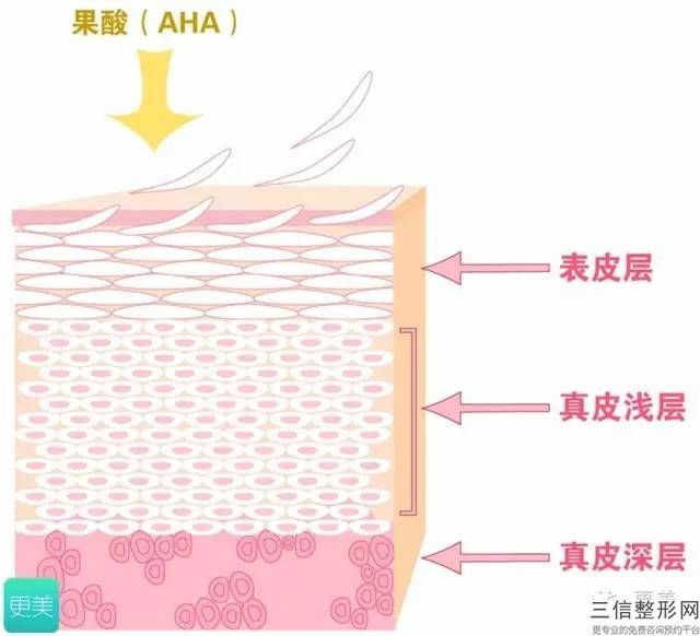 激光治療疤痕危險嗎？激光疤痕治療的注意事項！