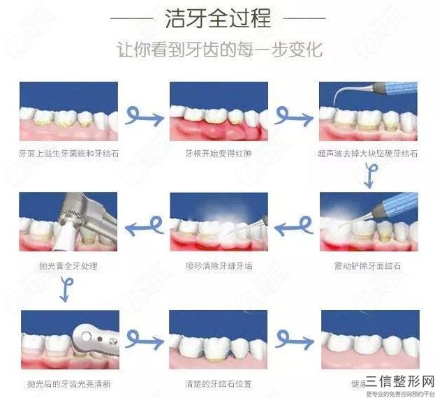 進(jìn)口國產(chǎn)全瓷牙資費(fèi)行情怎么樣？只有635行不行