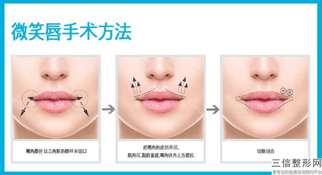 紋唇后可以馬上吃熱的、辛辣的食物嗎