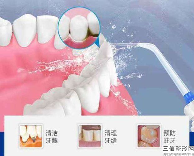 牙齒矯正后反而變齙牙，矯正完牙齒臉型會有變化么