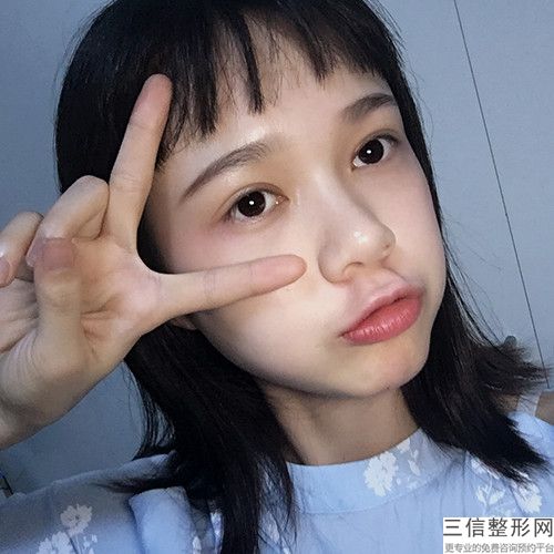 濟寧哪個整形醫院做雙眼皮好！濟寧韓美整形美容醫院實力非凡