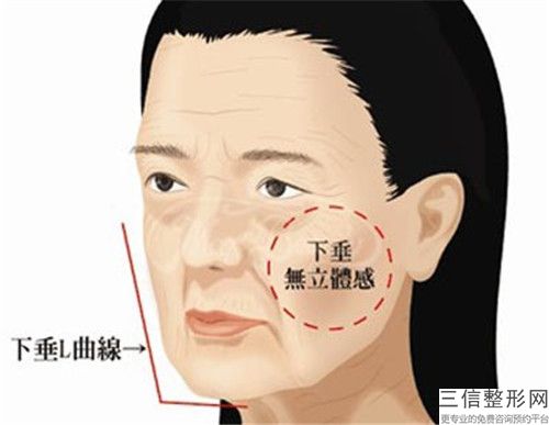 常州玻尿酸豐面頰美容效果好不好 價格多少錢（常州美萊美容整形醫院）