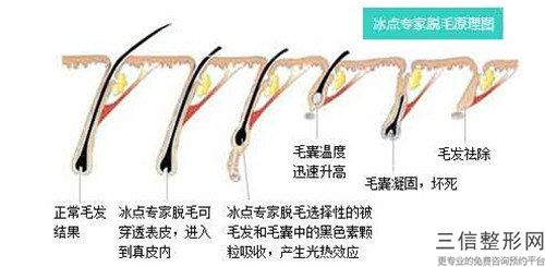 秦皇島市彩光脫腿毛美容科怎么樣(秦皇島市彩光脫腿毛整形醫院)