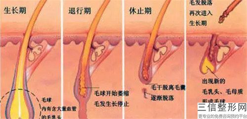 晉城市SHT毛發種植排名前八全新一覽提醒-晉城市SHT毛發種植整形醫院