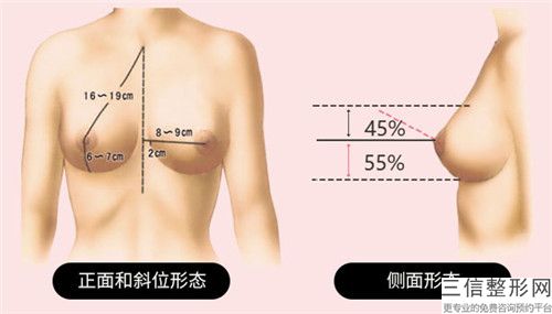 滁州市水滴隆胸醫生排名十強2022收官-劉靜醫生更可靠