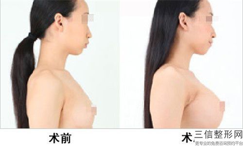 2023年聊城市乳暈脫毛醫院前十名排行權威大盤點(聊城市乳暈脫毛整形醫院)