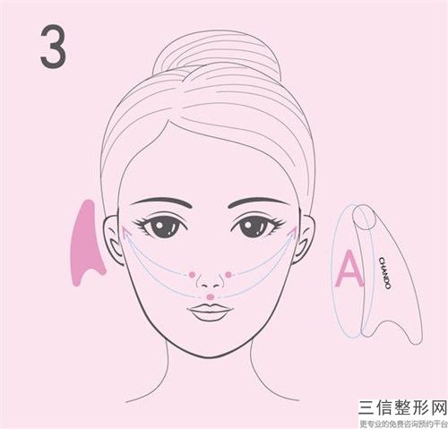 面部注射除皺針后有沒有副作用呢「面部注射除皺針的原理和副作用」