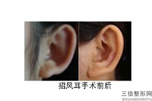 黑龍江省耳朵畸型醫院前十強排行一覽名單更新（黑龍江省耳朵畸型整形醫院）