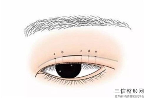 2023年江西省眼部手術除皺醫院前十位口碑榜口碑怎么樣(江西省眼部手術除皺整形醫院)