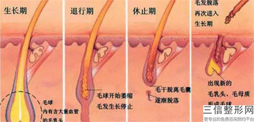 上饒頭皮擴(kuò)張術(shù)治療脫發(fā)整形手術(shù)費(fèi)多少