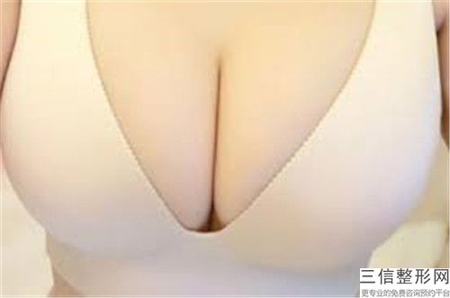 陽江市乳頭整形價位表上線一覽-陽江市乳頭整形美容價錢