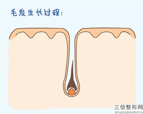 蘇州大學附屬兒童醫院整形科fue植發資料詳細介紹-附整形收費標準