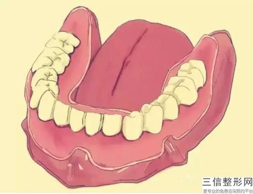 深圳東港門診部牙齒深覆合矯正安全不安全