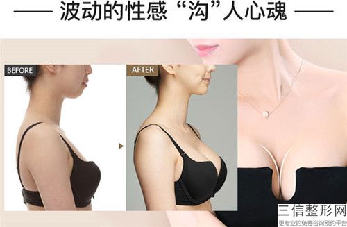 美容輕松矯正乳房下垂醫(yī)院推薦：輕松矯正乳房下垂醫(yī)院20強公示