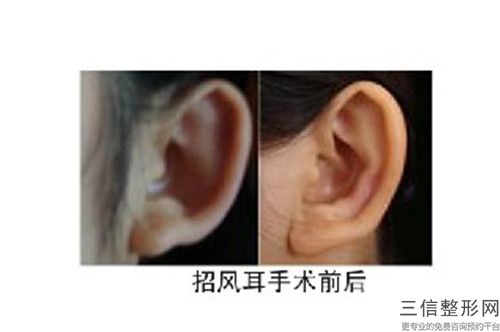 外耳再造排名醫生國內：外耳再造醫生前50強榜單推薦