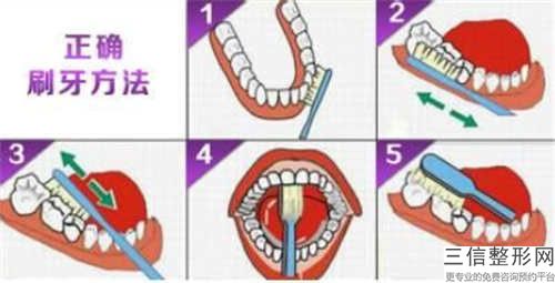 常德矯正牙齒牙根突出作用持續(xù)時(shí)間長(zhǎng)