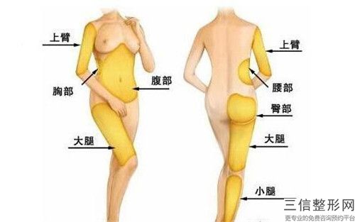 德宏360水動(dòng)力吸脂會(huì)影響到排汗嗎