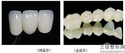 國際整形美容醫(yī)院純鈦金屬牙冠手術(shù)后護(hù)理有哪些