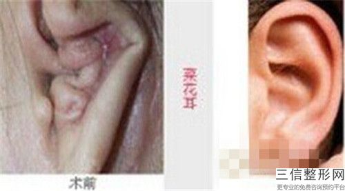 美容美容整形耳朵醫院推薦：美容整形耳朵醫院前20強大眾推薦