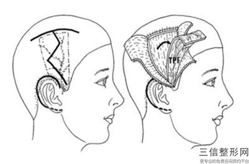 國內(nèi)生物再造耳醫(yī)院推薦：生物再造耳醫(yī)院TOP50強慕了