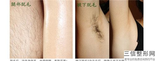 全國女性做植發醫院推薦：女性做植發醫院前50是時候發布了