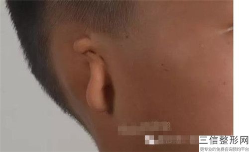 中國小孩杯狀耳醫院推薦：小孩杯狀耳醫院前50位榜單全新出爐