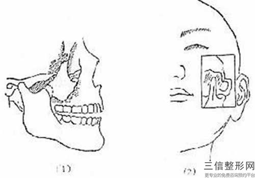 全國下頜骨頦孔醫(yī)院推薦：下頜骨頦孔醫(yī)院前50名公立私立五五分