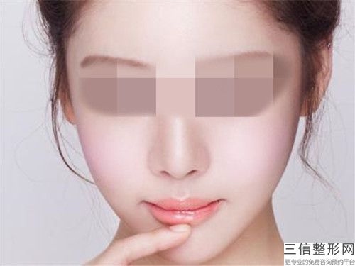 肇慶3d牙貼面有什么危害「肇慶3d牙貼面會不會出現危險」