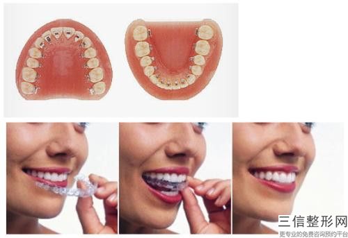 錦州空軍醫院整形科牙齒突出修復手術的安全性如何