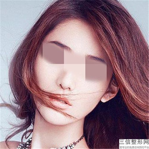 吉大一院美容整形外科價(jià)格(價(jià)目)表超人氣項(xiàng)目2025曝光-吸脂祛雙下巴案例