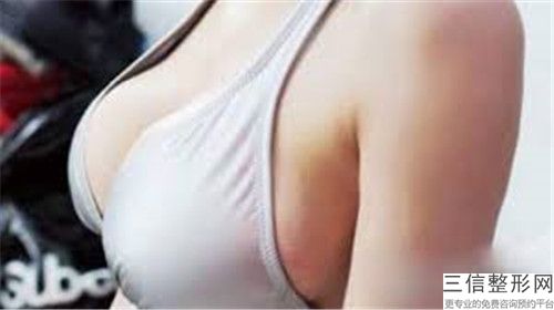 陽泉乳暈再造手術過程安全不安全