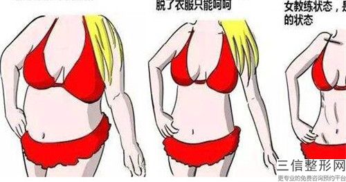 珠海大腿環形吸脂手術方法安全