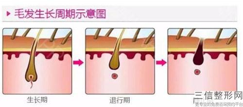 美容整形之植發(fā)美容功效_頭發(fā)移植后多長時間效果更突出