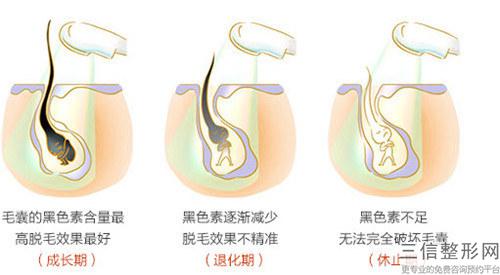 當今熱門的改善掉發的方法需好多錢