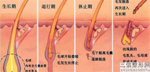 地中海毛發移植起到的作用到底如何