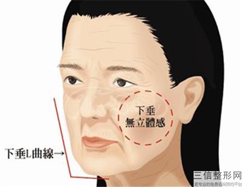 注水光*會光亮面部肌膚是否正確，那能夠實現改善斑嗎？