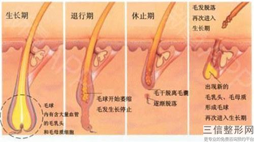 眉毛移植多少錢才能治好